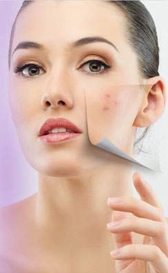 limpieza-facial-cuidado-de-la-piel-clinica-del-acne